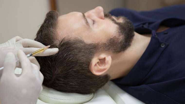 Tricks for Finding the Right Hair Loss Supplements for Men