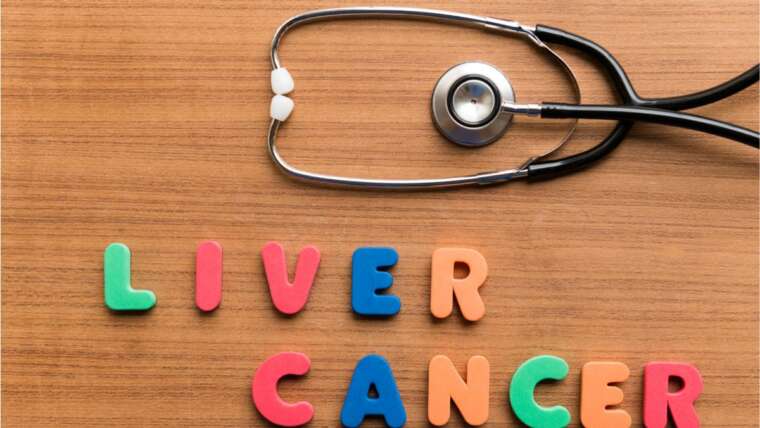 Discover Expert Ideas Your Ultimate Guide to Choosing a Top-notch Liver Cancer Doctor