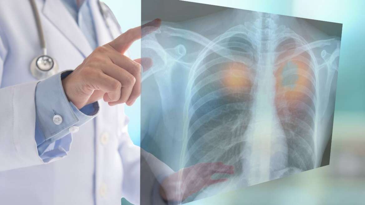 Top 10 Innovative Ways to Navigate Lung Cancer Clinical Trials Successfully