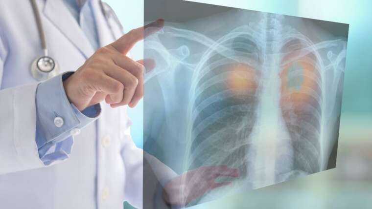 Top 10 Innovative Ways to Navigate Lung Cancer Clinical Trials Successfully